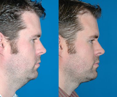 How to lose belly fat naturally in just 10 days picture 10
