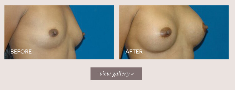 breast-and-body-gallery.jpg breast-and-body-gallery.jpg