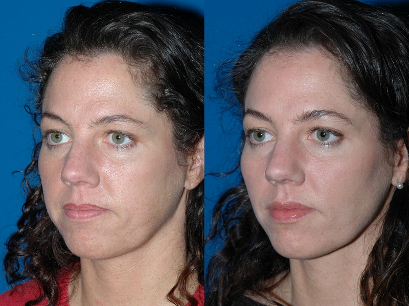 buccal04.jpg
