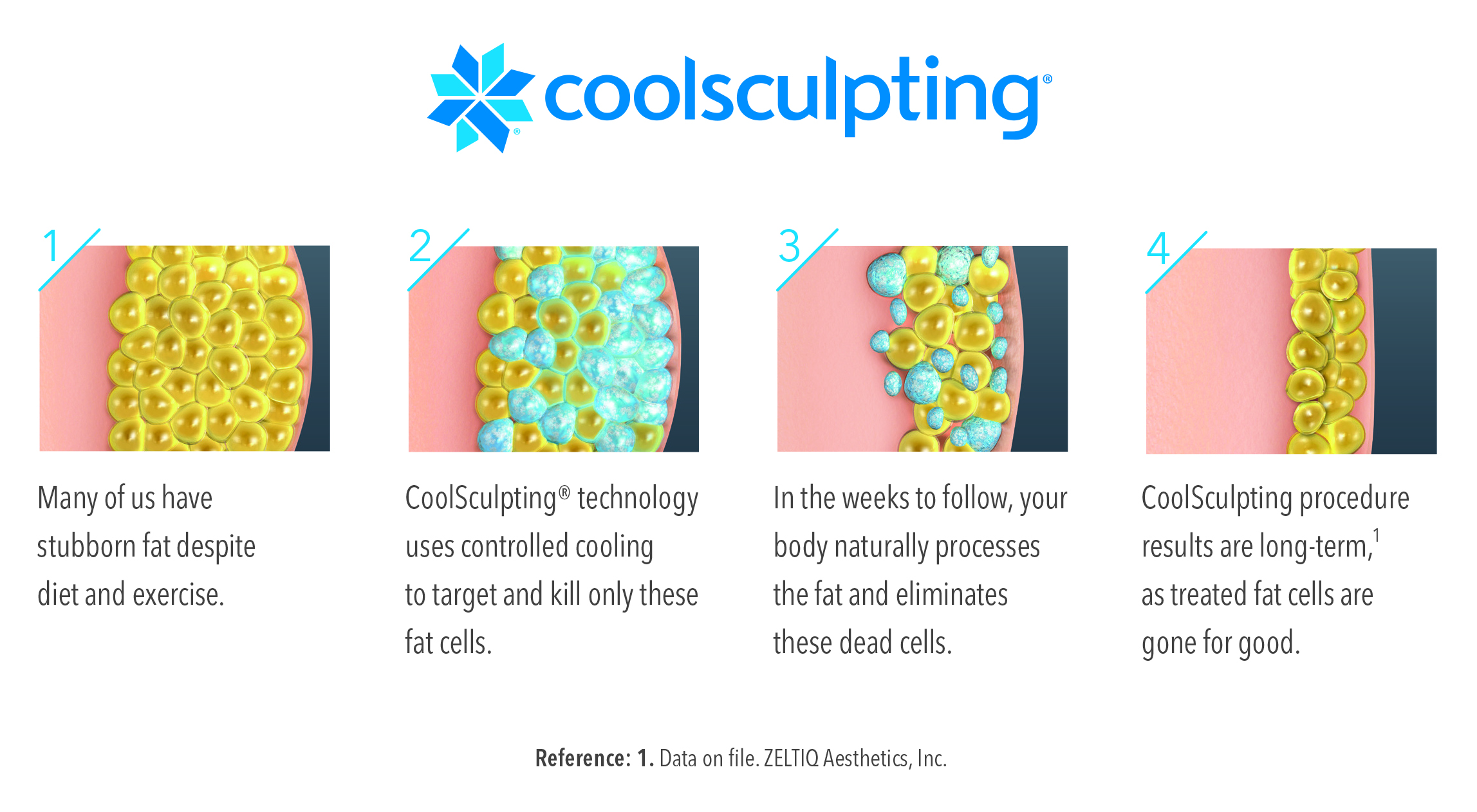 coolsculpting-image.jpg