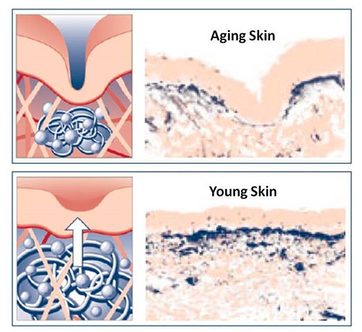 hyaluronic-acid-aging-skin.jpg