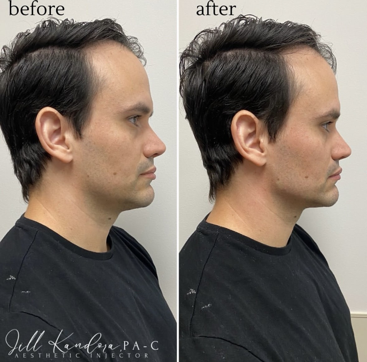 jill-hubs.jpg jill-hubs.jpg