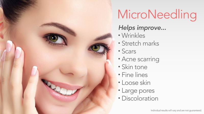 microneedling ogden