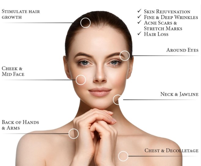 prp-snip.jpg prp-snip.jpg