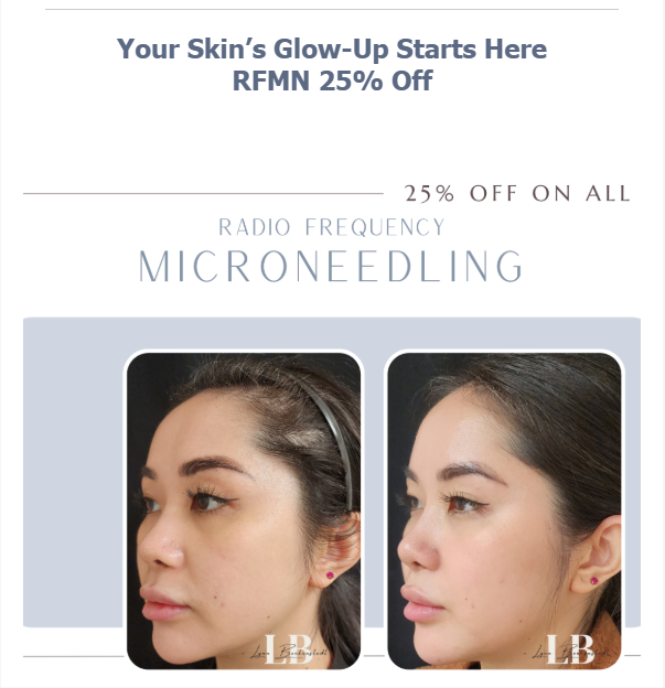 rf-microneedling.png