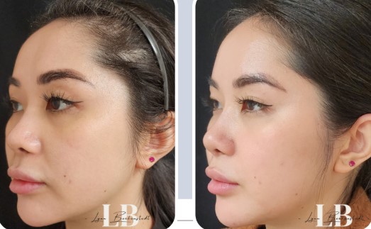 rfmn-snip.jpg rfmn-snip.jpg